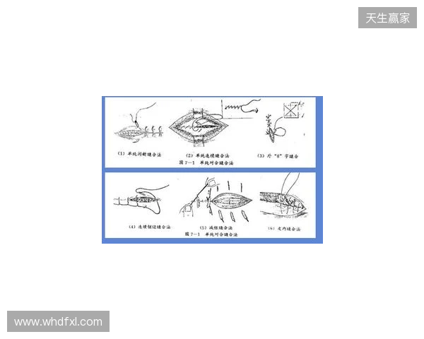 广州豹官方:杨浩眉弓伤口缝合30余针,预计5-7天后拆线 广州豹官方:杨浩眉弓伤口缝合30余针,预计5-7天后拆线